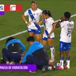 Se alcanza a distinguir el hilo blanco de la dra. #RYtPE7UM